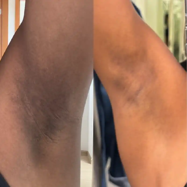 Trio Clareador - R$ 49,90 cada unidade